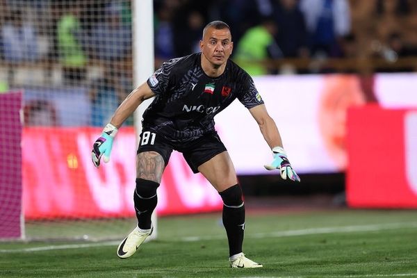 تغییر چهره عجیب حامد لک