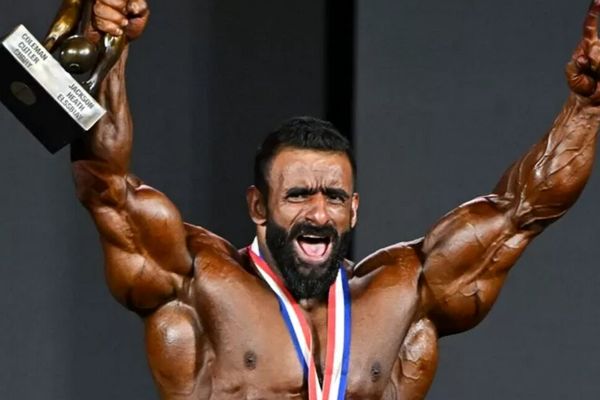 هادی چوپان تغییر چهره داد 