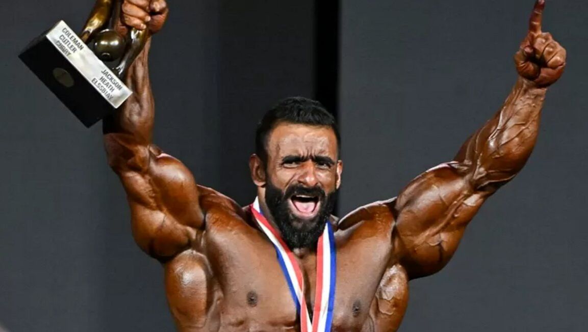 هادی چوپان تغییر چهره داد 