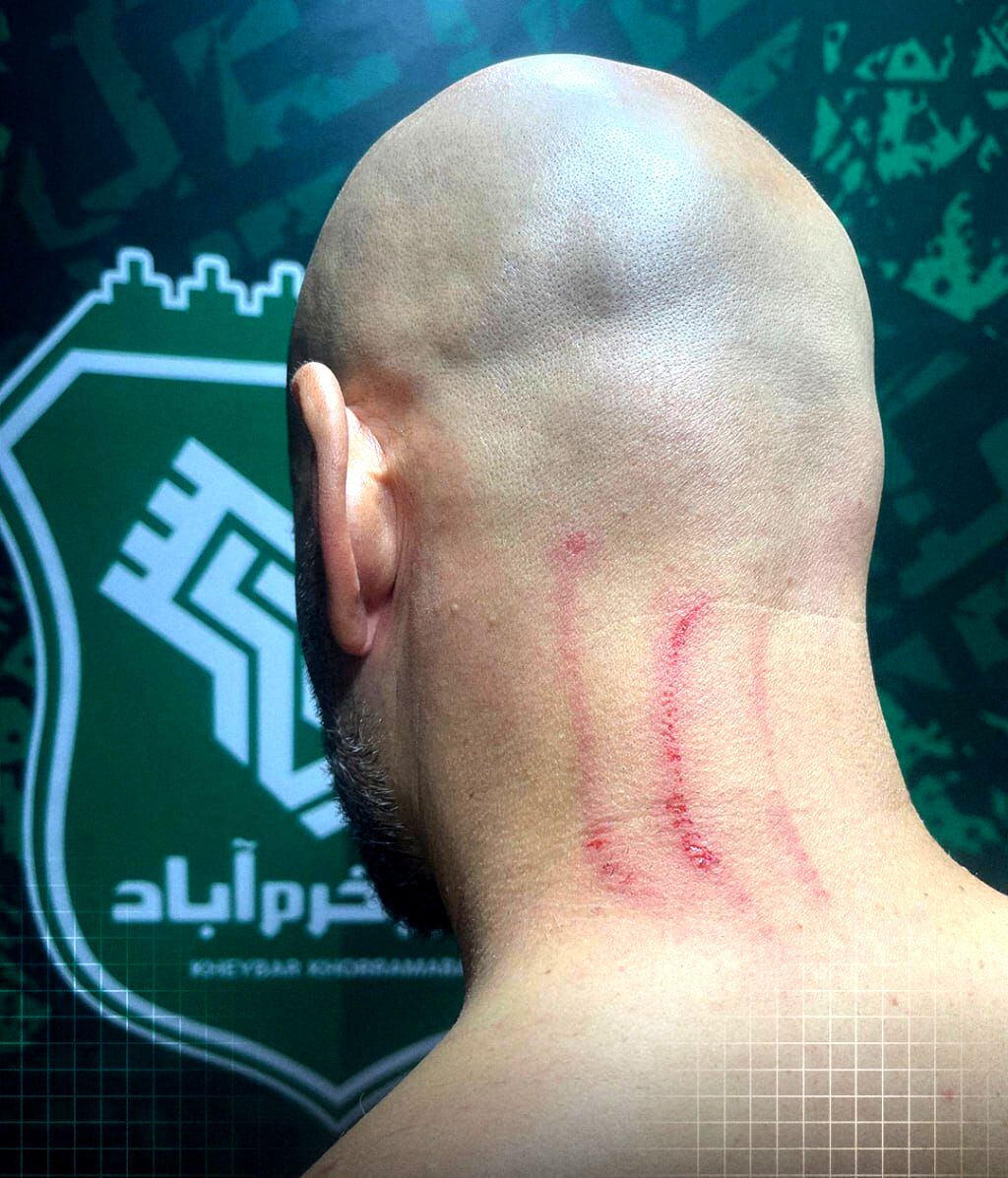 استقلال سند رو کرد: جای چنگ روی سرِ مربی!
