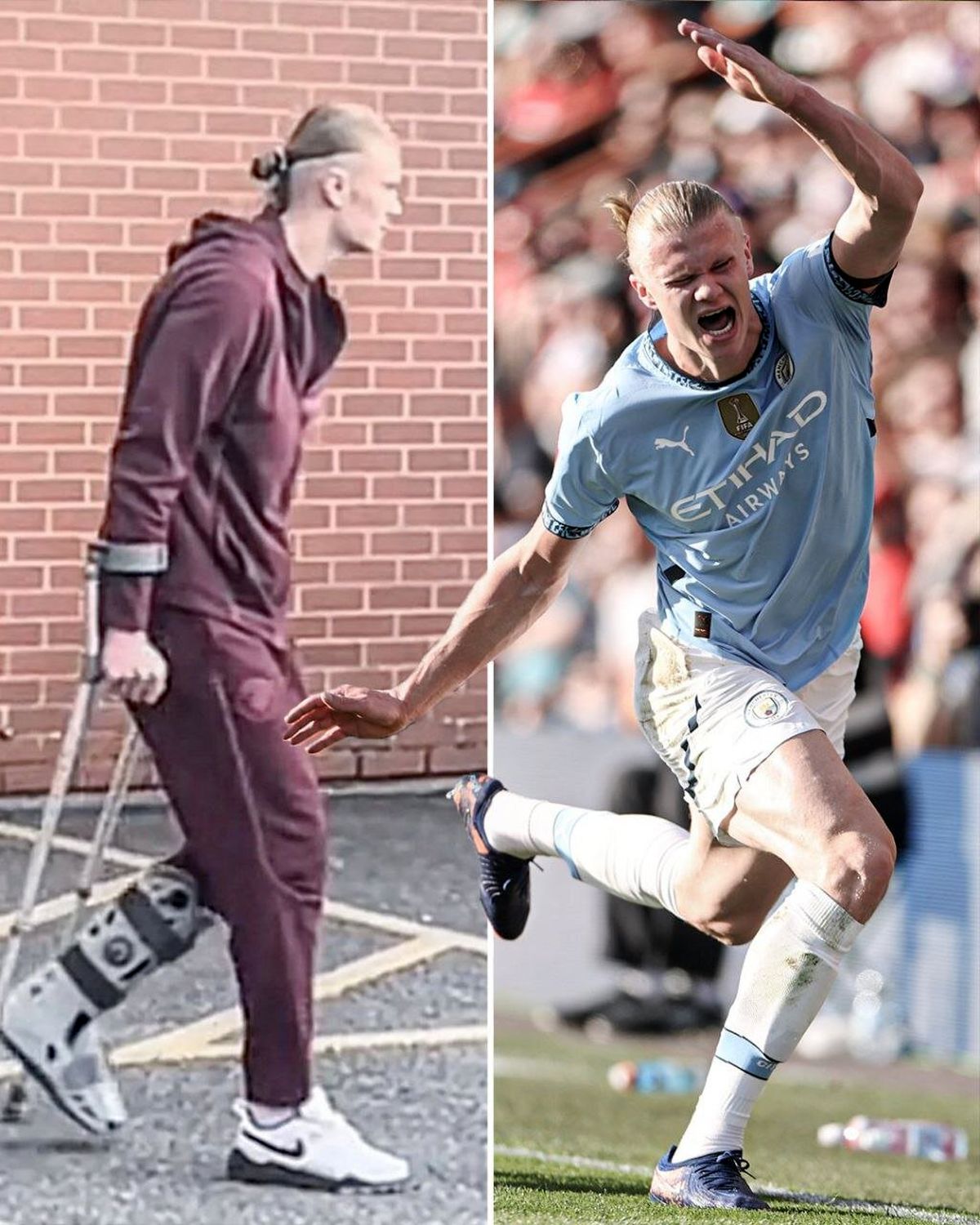 ببینید/ شرایط نگران‌کننده شد/ خروج هالند از ورزشگاه با محافظ پا و عصا پس از مصدومیت