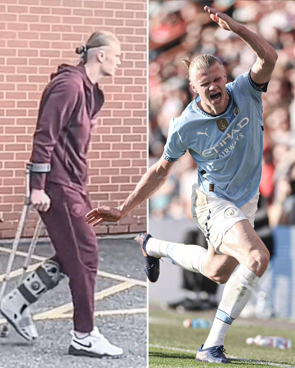 ببینید/ شرایط نگران‌کننده شد/ خروج هالند از ورزشگاه با محافظ پا و عصا پس از مصدومیت